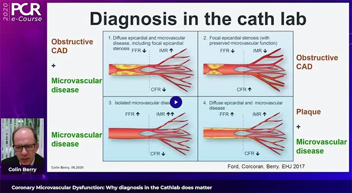 Comprehensive Diagnosis with Physiology Indices