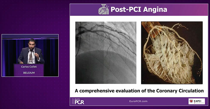 Importance of Coronary Microvascular Dysfunction (CMD) Diagnostic Testing