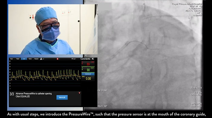 INOCA Procedure video    