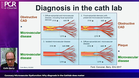 Diagnosis in the cath lab