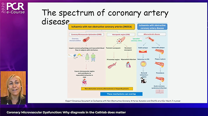 The spectrum of coronary artery disease