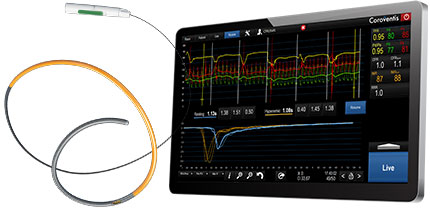 PressureWire™ X Guidewire and CoroFlow‡ Cardiovascular System