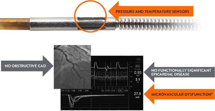 Pressure and temperature sensors