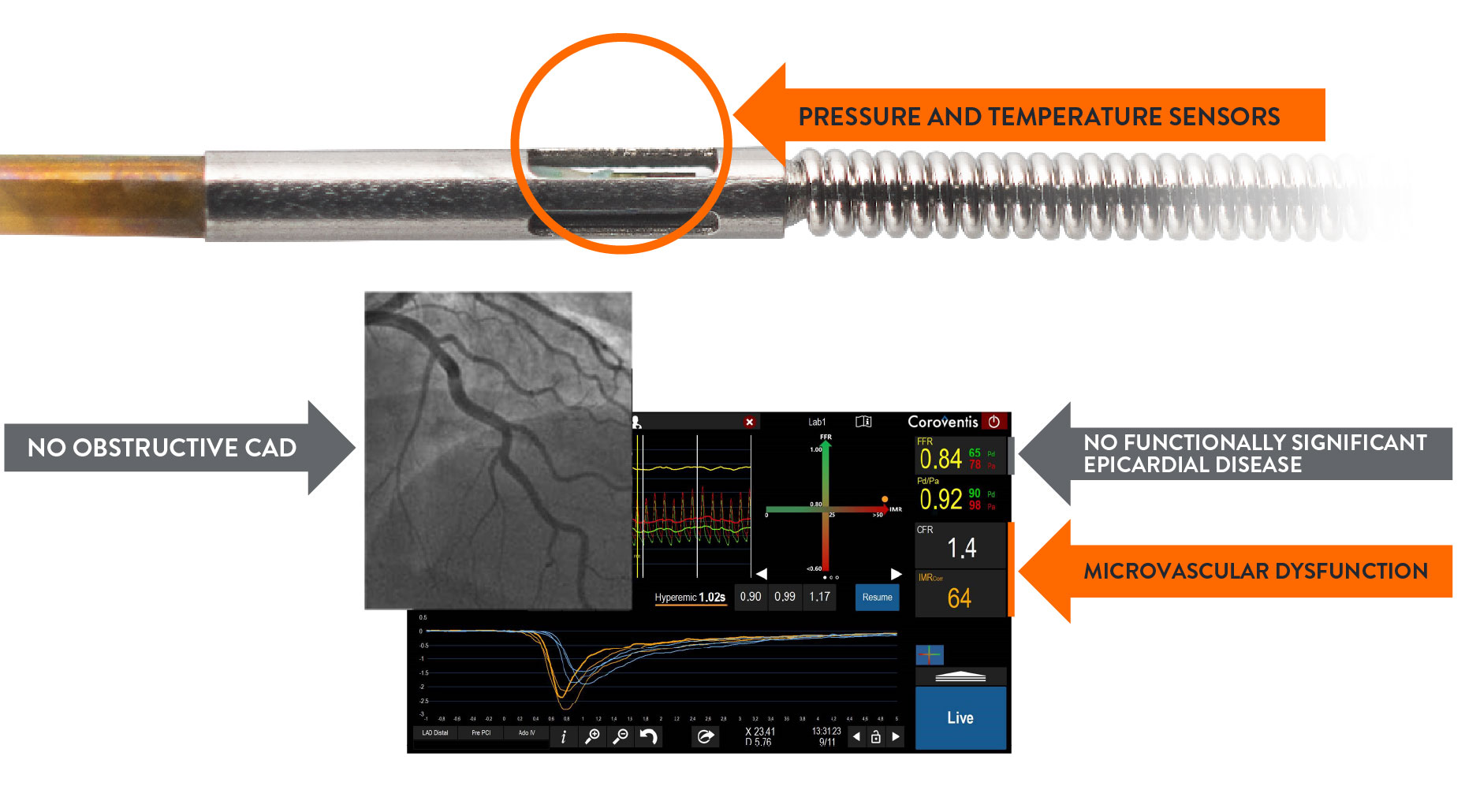 Pressure and temperature sensors