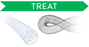 Treat peripheral artery disease