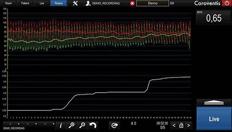  RFR Pullback