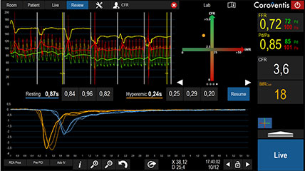  CoroFlow Cardiovascular System