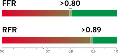  RFR Cutoff Value