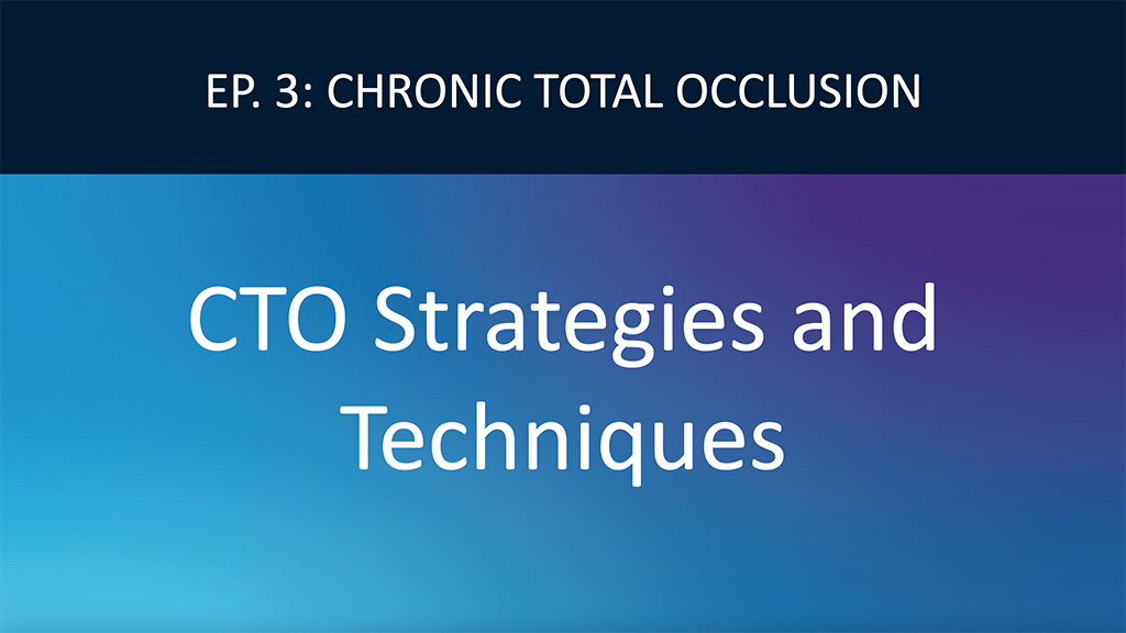Algorithmic Approach to CTO Strategies and Techniques Video