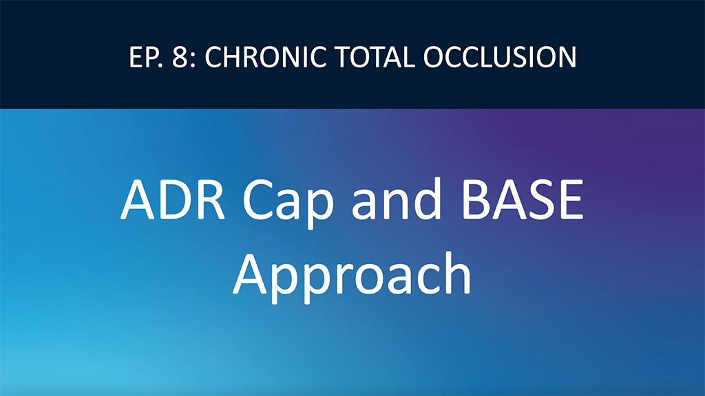 ADR CAP and BASE approach to CTO PCI Video