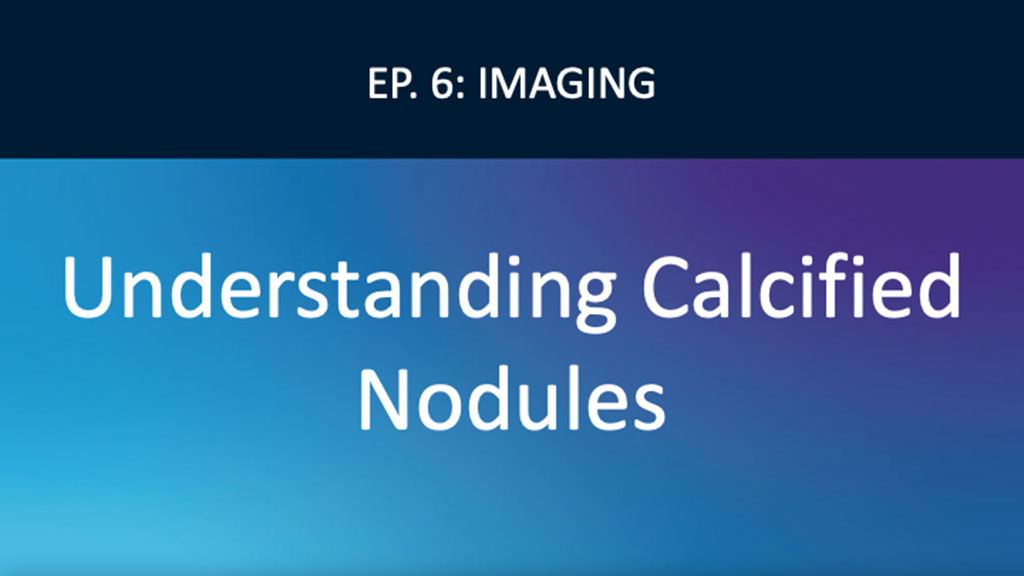 Using Coronary Imaging to Identify Calcified Nodules