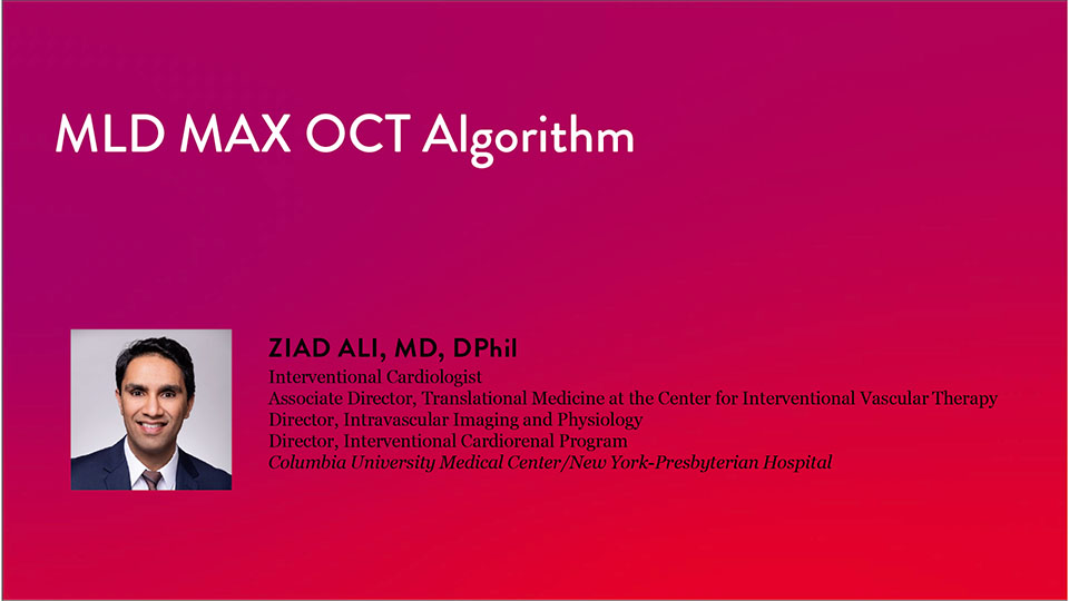 MLD MAX OCT Algorithm