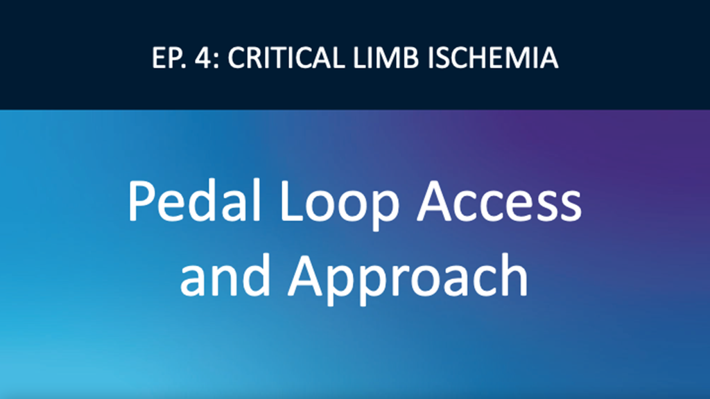 Pedal Loop Access and Approach
