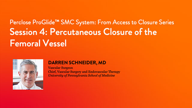 ProGlide - from access to closure