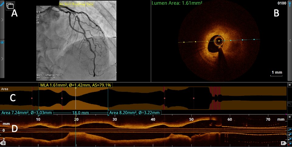  pci oct interface visual