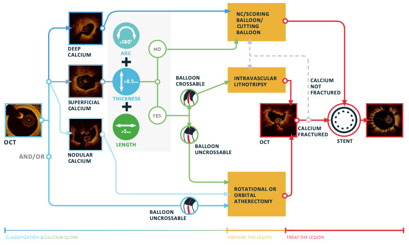 How to diagnose and treat calcified lesions