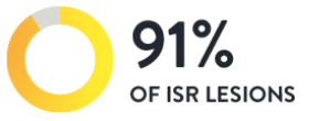 91％ のISR病変
