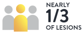  nearly one third of lesions graphic