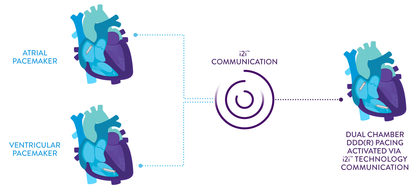 Dual Chamber DDDR Pacing