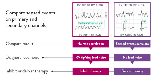 Compare sensed events on primary and secondary channels. Compare rate, diagnose lead noise, inhibit or delivery therapy.