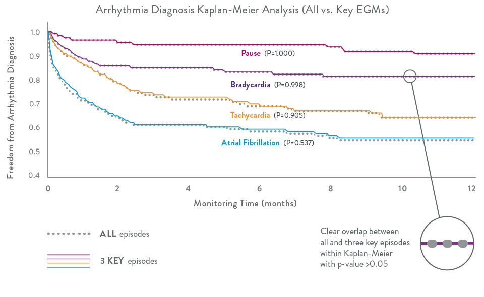 Arrhythmia Diagnosis