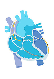  Better management of heart failure symptoms