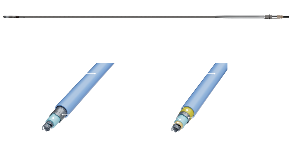 UltiPace cross section