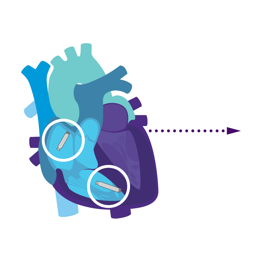 AVEIR VR in heart