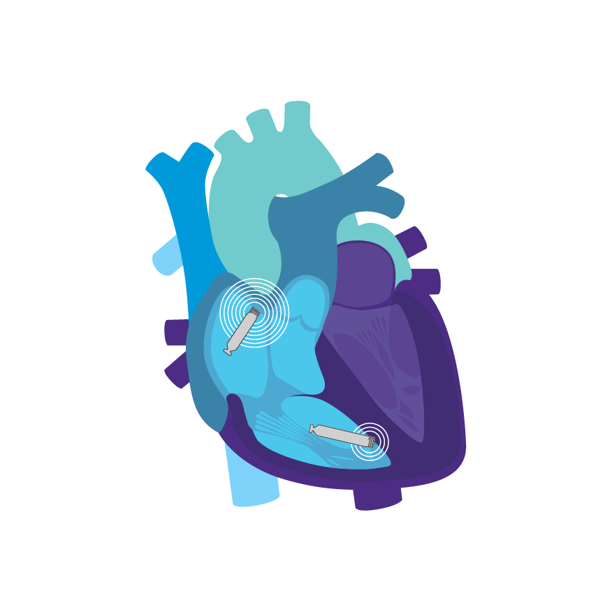 AVEIR DR in heart