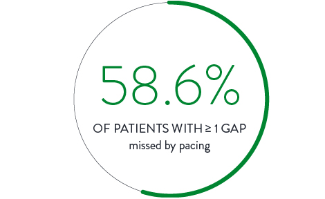 Putting The “Heterogeneous” In The HSA Foundation