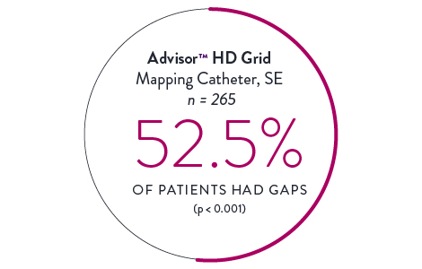 HD Grid Mapping Cathethers 52.5%