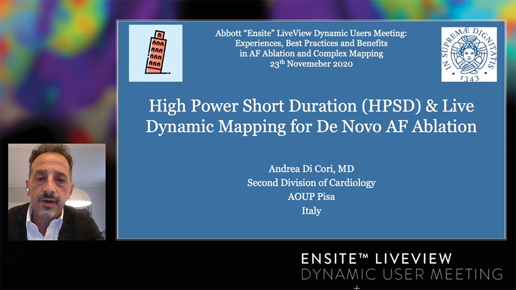 Live Dynamic Visualization of the Pulmonary Veins and High Power Short Duration ablation