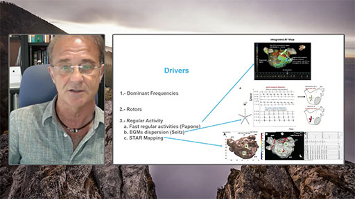 Dr. Martínez-Alday shares his workflow to underlying areas of interest in Persistent Atrial Fibrillation with the tools CFE Mean and CFE Standard Deviation