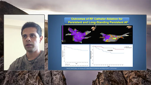 Dr. Sousa shares his tailored approach for Persistent Atrial Fibrillation