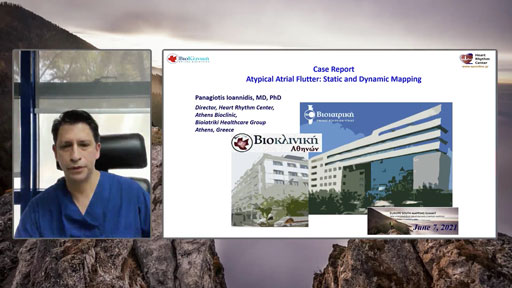 Dr. Ioannidis shows a case report on a left Atypical Atrial Flutter combining the High-Density Static Map with the new Live Dynamic Visualization