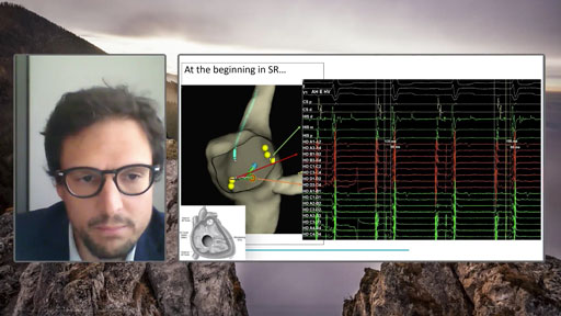 Congenital with the HD Grid combining the Static Map with the new Live Dynamic Visualization