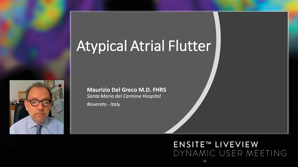 Right atrium AAFL combining the High Density Static Map with the new Live Dynamic Visualizatio