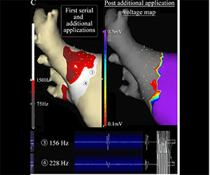 EnSite™ OT Near Field  - peak frequency value of catheter electrodes