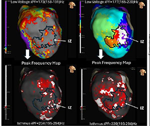 EnSite™ OT Near Field Detailed Analysis of Electrogram Peak Frequency