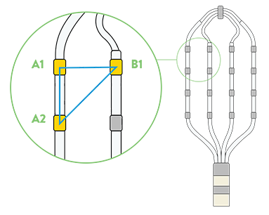 EnSite Omnipolar Technology