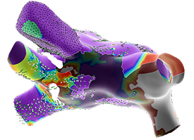 EnSite OT emphasis map