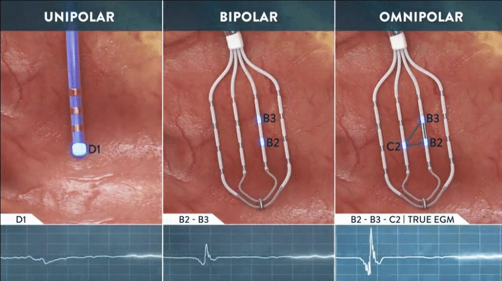 EnSite Omnipolar Technology