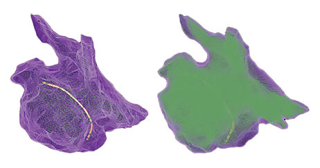 Two 3D cardiac models depicting the higher point density.