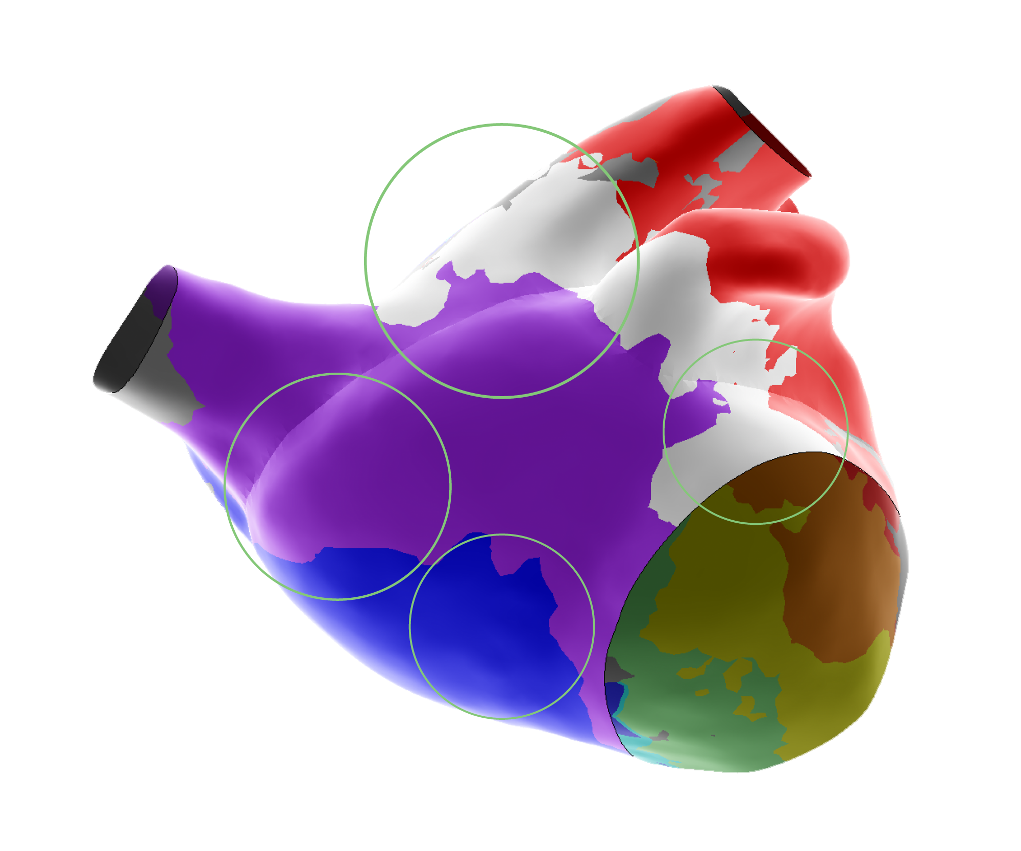 EnSite X Map with Outlier Filter On