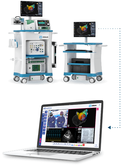 EnSite X EP System with EnSite Connect Remote Support