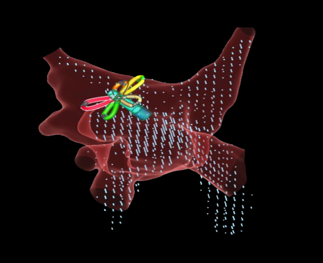 EnSite Navigation Mode Map