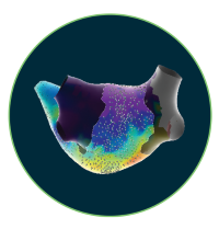 EnSite™ OT Near Field software