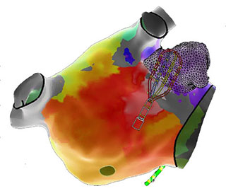 EnSite Electrogram