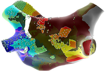 PVI with Peak Frequency and Emphasis Maps