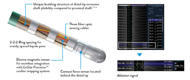 Nahaufnahmen des TactiCath™ Ablationskatheters mit Anpressdruckmessung, Sensor Enabled™, zur Verdeutlichung bestimmter Katheterfunktionen.